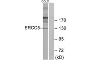 Western blot analysis of extracts from COLO cells, using ERCC5 Antibody. (ERCC5 抗体  (AA 131-180))