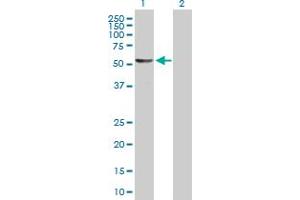 Western Blot analysis of DALRD3 expression in transfected 293T cell line by DALRD3 MaxPab polyclonal antibody. (DALRD3 抗体  (AA 1-543))