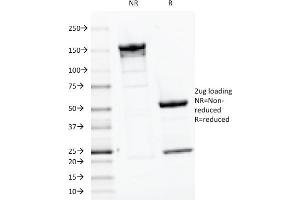 SDS-PAGE Analysis Purified PTH Mouse Monoclonal Antibody (PTH/1175). (PTH 抗体  (AA 32-115))