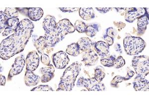 Detection of CHEM in Human Placenta Tissue using Monoclonal Antibody to Chemerin (CHEM) (CHEM (AA 33-158) 抗体)