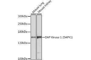Western blot analysis of extracts of various cell lines, using DAP Kinase 1 (DAP Kinase 1 (D)) Antibody (ABIN6130240, ABIN6139401, ABIN6139402 and ABIN6221411) at 1:1000 dilution. (DAP Kinase 1 抗体  (AA 1141-1430))