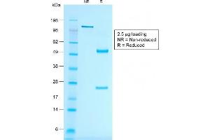 SDS-PAGE Analysis of Purified MART-1 Mouse Recombinant Monoclonal Antibody (rMLANA/788). (Recombinant MLANA 抗体)