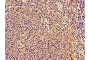 Immunohistochemistry of paraffin-embedded human lymph node tissue using ABIN7173031 at dilution of 1:100 (TMEM11 抗体  (AA 1-83))