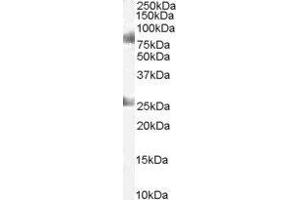 Western Blotting (WB) image for Chromodomain Protein, Y-Like (CDYL) peptide (ABIN369898) (Chromodomain Protein, Y-Like (CDYL) Peptide)