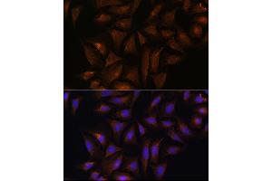 Immunofluorescence analysis of U-2 OS cells using CRYZ Rabbit pAb  at dilution of 1:100 (40x lens). (CRYZ 抗体  (AA 1-329))