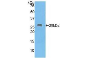 Detection of Recombinant PKD2, Human using Polyclonal Antibody to Protein Kinase D2 (PKD2)