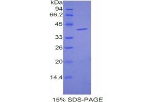 SDS-PAGE analysis of Mouse Cholecystokinin Protein. (Cholecystokinin Protein (CCK))