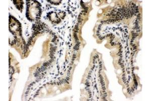 IHC testing of FFPE mouse intestine with CTCF antibody.