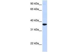 Image no. 1 for anti-Secretagogin, EF-Hand Calcium Binding Protein (SCGN) (AA 180-229) antibody (ABIN6743096) (SCGN 抗体  (AA 180-229))
