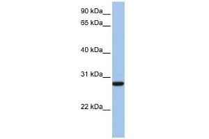 VDAC3 antibody used at 1 ug/ml to detect target protein. (VDAC3 抗体  (N-Term))
