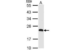 WB Image Sample (30 ug of whole cell lysate) A: Raji 12% SDS PAGE CKLFSF5 antibody antibody diluted at 1:500 (CMTM5 抗体  (N-Term))