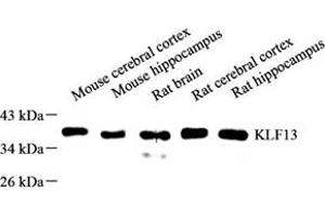 Western blot analysis of KLF13 (ABIN7074445) at dilution of 1: 500 (KLF13 抗体)