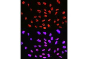 Immunofluorescence (IF) image for anti-Kruppel-Like Factor 4 (Gut) (KLF4) antibody (ABIN7268157)