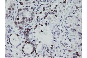 Image no. 1 for anti-Early Growth Response 2 (EGR2) (AA 156-476) antibody (ABIN1490982) (EGR2 抗体  (AA 156-476))