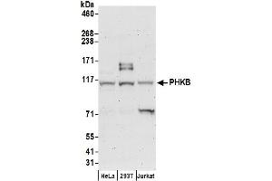 anti-Phosphorylase Kinase, beta (PHKB) (AA 650-700) antibody