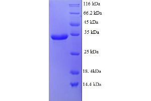 SDS-PAGE (SDS) image for G Protein-Coupled Receptor 75 (GPR75) (AA 372-540) protein (His-SUMO Tag) (ABIN5709609)