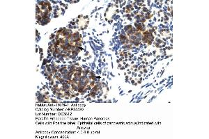 Human Pancreas (TRIM41 抗体  (C-Term))