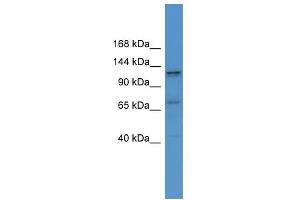 WB Suggested Anti-ERC1 Antibody Titration: 0. (ERC1 抗体  (C-Term))