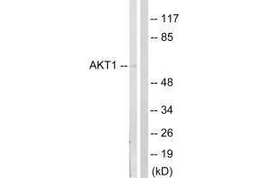 Western blot analysis of extracts from NIH/3T3cells, treated with PDGF (50 mg /mL, 20 mins), using Akt (Ab-124) antibody. (AKT1 抗体  (Ser124))