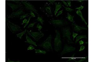 Immunofluorescence of monoclonal antibody to LRRN1 on HeLa cell. (LRRN1 抗体  (AA 1-716))