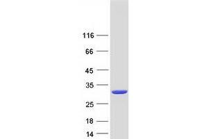 Glutathione S-Transferase alpha 3 (GSTA3) protein (Myc-DYKDDDDK Tag)