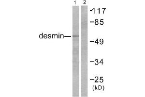 Western blot analysis of extracts from K562 cells, using Desmin antibody. (Desmin 抗体  (C-Term))