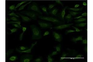 Immunofluorescence of monoclonal antibody to IL15 on HeLa cell. (IL-15 抗体  (AA 49-162))