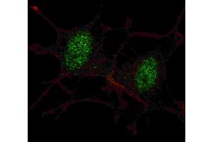 Fluorescent confocal ige of SY5Y cells stained with SD2 antibody. (SMAD2 抗体  (AA 97-125))