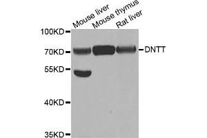 Western Blotting (WB) image for anti-Deoxynucleotidyltransferase, terminal (DNTT) antibody (ABIN1882380) (TdT 抗体)