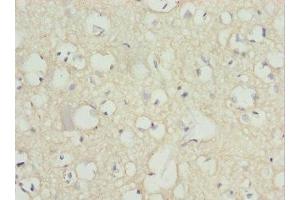 Immunohistochemistry of paraffin-embedded human brain tissue using ABIN7162977 at dilution of 1:100 (PEX14 抗体  (AA 118-377))