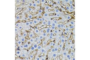 Immunohistochemistry of paraffin-embedded mouse liver using CBL antibody (ABIN5995395) (40x lens). (CBL 抗体)