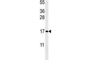 CCL4 antibody western blot analysis in mouse bladder tissue lysate (15ug/lane). (CCL4 抗体  (AA 22-48))
