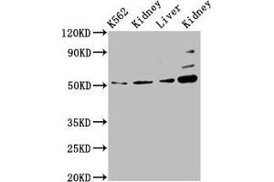 Western Blot Positive WB detected in: K562 whole cell lysate, Rat kidney tissue, Mouse liver tissue, Mouse kidney tissue All lanes: GSS antibody at 5. (Glutathione Synthetase 抗体  (AA 290-418))
