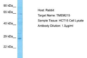 Host: Rabbit Target Name: TMEM215 Sample Type: HCT15 Whole Cell lysates Antibody Dilution: 1. (TMEM215 抗体  (N-Term))