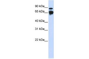 Amphiphysin antibody used at 1 ug/ml to detect target protein. (Amphiphysin 抗体  (N-Term))