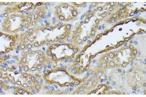 Immunohistochemistry of paraffin-embedded Rat kidney using DAPK3 Polyclonal Antibody at dilution of 1:100 (40x lens). (DAPK3 抗体)