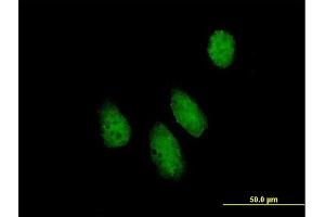 Immunofluorescence of purified MaxPab antibody to NUPL1 on HeLa cell. (NUPL1 抗体  (AA 1-599))