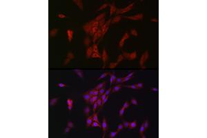 Immunofluorescence analysis of PC-12 cells using METTL4 Rabbit pAb (ABIN6133091, ABIN6143773, ABIN6143774 and ABIN6224964) at dilution of 1:100 (40x lens).