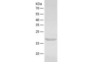 Western Blotting (WB) image for Dihydrofolate Reductase (DHFR) (AA 1-187) protein (His tag) (ABIN7122665) (Dihydrofolate Reductase Protein (DHFR) (AA 1-187) (His tag))