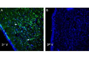 Expression of P2X6 in rat hypothalamus.