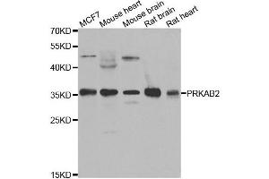 Western blot analysis of extracts of various cell lines, using PRKAB2 antibody.