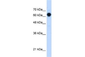 WB Suggested Anti-C3orf39 Antibody Titration:  1. (C3orf39 抗体  (Middle Region))