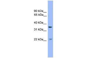 Western Blotting (WB) image for anti-Zinc Finger, DHHC-Type Containing 21 (ZDHHC21) (Middle Region) antibody (ABIN2786363)