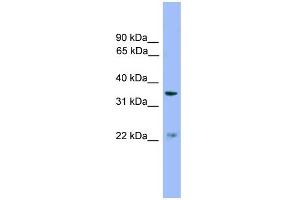 WB Suggested Anti-ZDHHC21 Antibody Titration: 0. (ZDHHC21 抗体  (Middle Region))