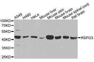 Western blot analysis of extracts of various cell lines, using RSPO3 antibody. (R-Spondin 3 抗体  (AA 1-100))