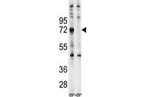 Western blot analysis of Ubiquilin-1 antibody pre-incubated with and without blocking peptide in Jurkat lysate (Ubiquilin 1 抗体  (AA 40-70))