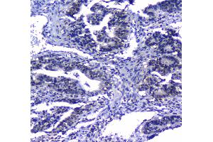 Immunohistochemistry (IHC) image for anti-MYC Associated Factor X (MAX) (AA 30-106) antibody (ABIN5692891)