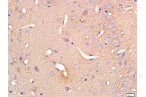 Formalin-fixed and paraffin embedded rat brain labeled with Anti-Serine Racemase Polyclonal Antibody, Unconjugated  at 1:200 followed by conjugation to the secondary antibody and DAB staining (SRR 抗体  (AA 1-100))