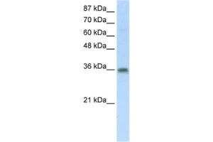 Western Blotting (WB) image for anti-Transformer 2 beta Homolog (TRA2B) antibody (ABIN2462167) (TRA2B 抗体)