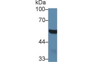 Western Blot; Sample: Mouse Cerebrum lysate; Primary Ab: 1µg/ml Rabbit Anti-Mouse ABAT Antibody Second Ab: 0. (ABAT 抗体  (AA 236-500))